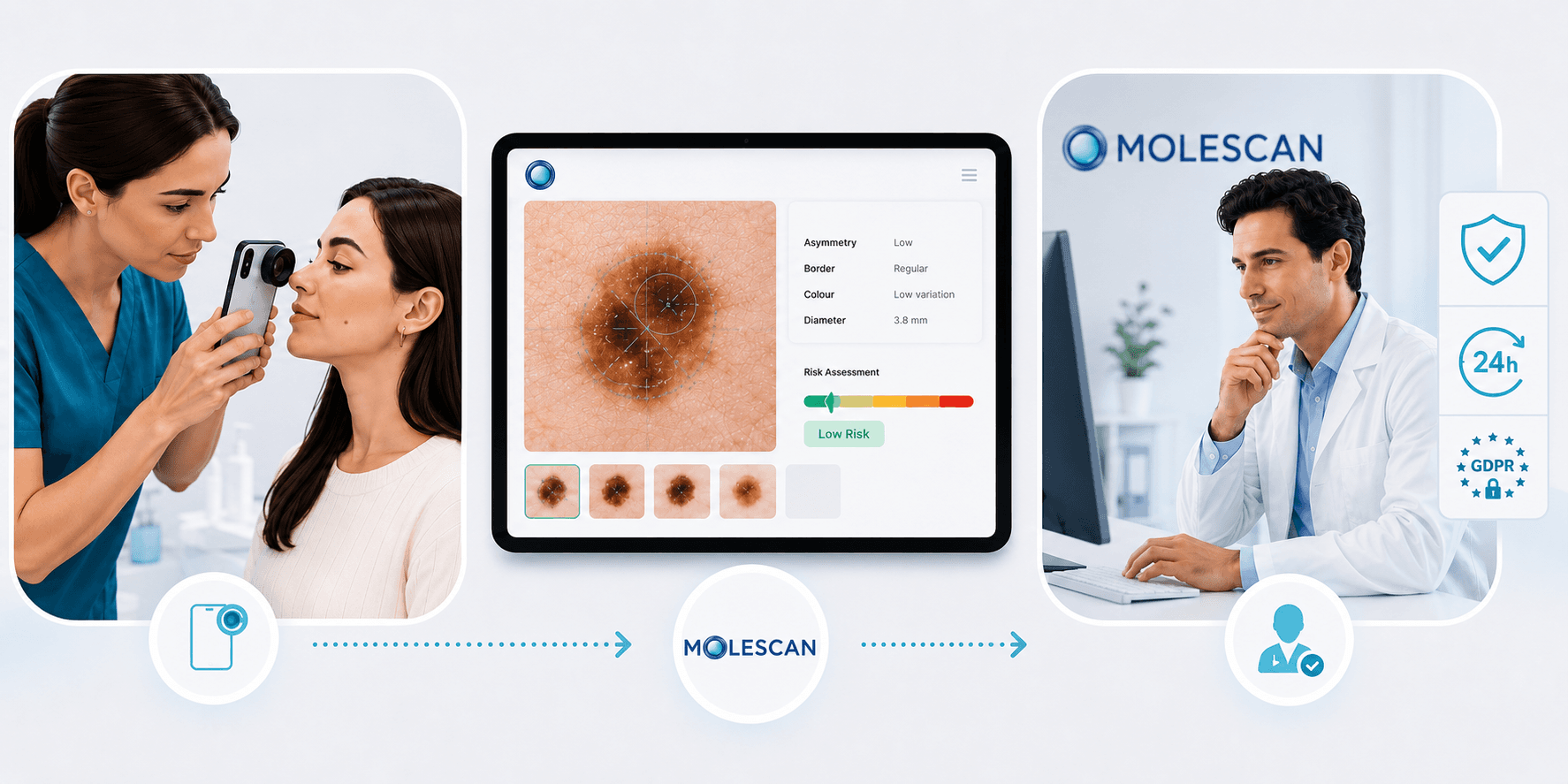 Illustrated infographic showing MoleScan dermatologist-led skin lesion assessment workflow — a practitioner captures a mole image with a dermoscope, expert dermatologists assess the lesion for risk stratification, and a UK GP or dermatologist reviews and delivers a structured report within 24 hours